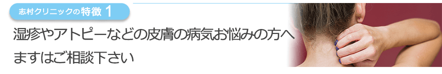 湿疹やアトピーなどの皮膚の病気でお悩みの方へ、ますはご相談下さい